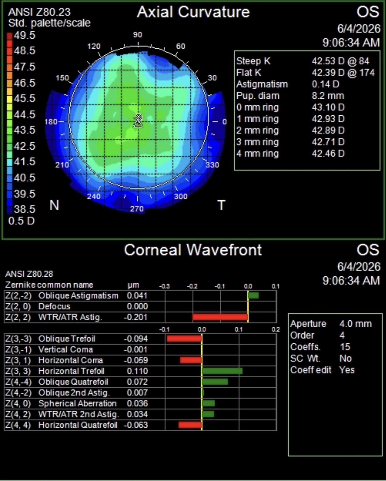 Post-operative corneal topography — 0.14 D astigmatism after astigmatic keratotomy